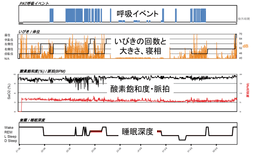 睡眠リテラシー第4回 Objective Summaryの見方